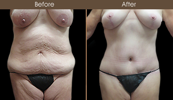 20202608153625_B93-Front-Template